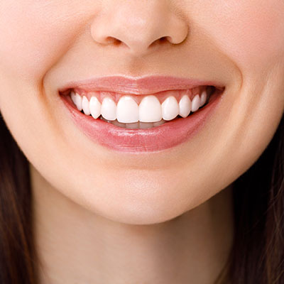 The image shows a woman with a radiant smile, displaying her teeth and gums, against a neutral background.