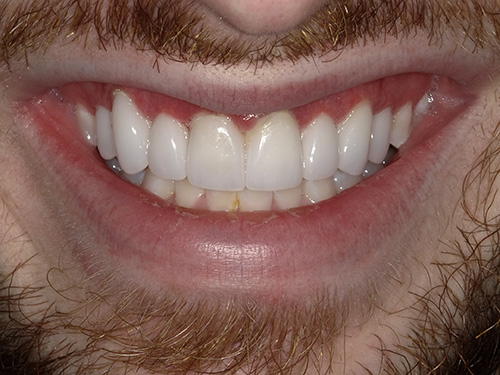 Flex Family Dentistry | Dental Cleanings, Crowns amp Caps and Digital Radiography