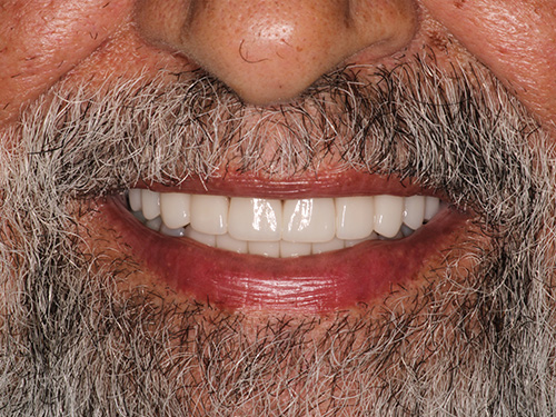 Flex Family Dentistry | Emergency Treatment, Dental Fillings and Night Guards