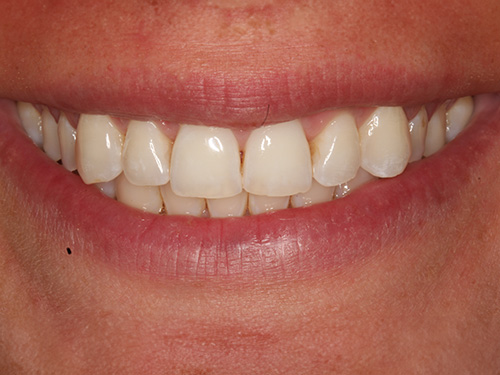 The image displays a close-up view of a person s smiling face with teeth, showcasing a bright smile and a clear complexion.