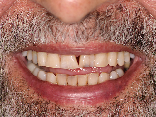 Flex Family Dentistry | Habit Counseling, Full Mouth Reconstruction and Oral Exams